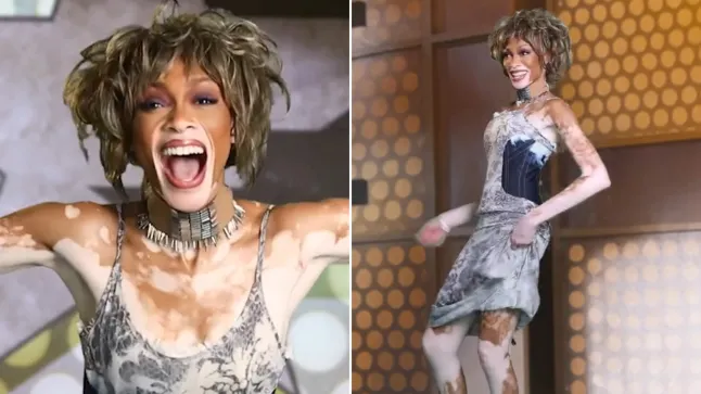 Winnie Harlow Responds to Backlash Over Whitney Houston Halloween Costume: “I Was Not Mocking Her”